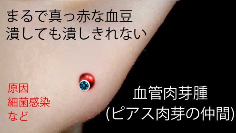 違いを見分ける方法